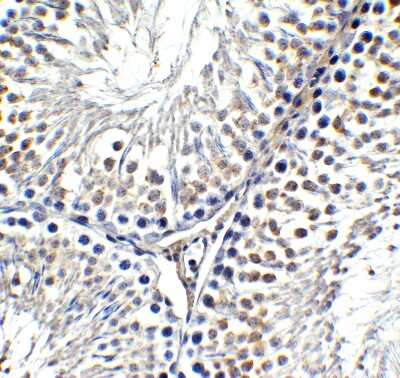 Immunohistochemistry-Paraffin: AMID Antibody - BSA Free [NBP3-18132]